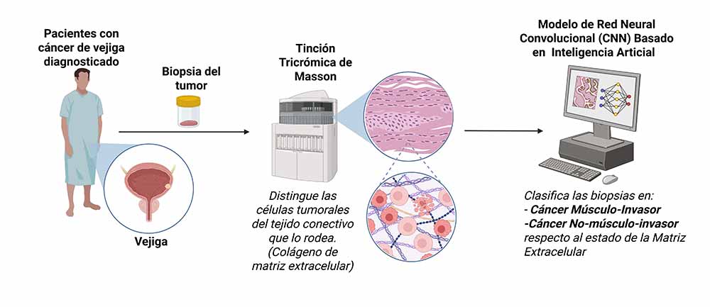 Hospital de Rancagua desarrolla modelo de inteligencia artificial para cáncer de vejiga